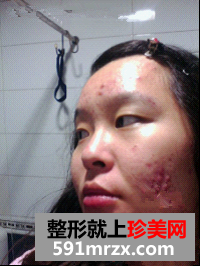 大美妞的祛痘经历 屌丝女逆袭白富美
