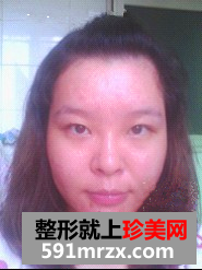 大美妞的祛痘经历 屌丝女逆袭白富美