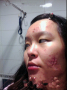 大美妞的祛痘经历屌丝女逆袭白富美
