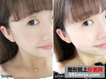 【innerb】来自韩国的火爆口服化妆品-innerb效果分享