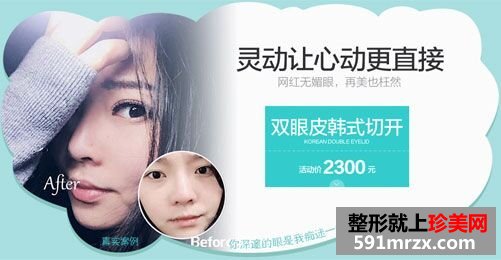 全切双眼皮恢复过程前后对比真人案例效果照片图