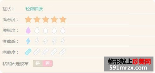 全切双眼皮恢复过程前后对比真人案例效果照片图