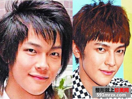 盘点娱乐圈男士下颌角整形成功案例 简直完美无痕