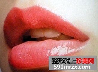 做了玻尿酸注射丰唇珠后，没涂唇彩也美丽