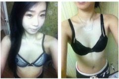 韩国隆胸手术做的效果好不好?看了就知道