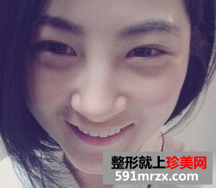 趁着还年轻，我决定去做侍美牙齿矫正