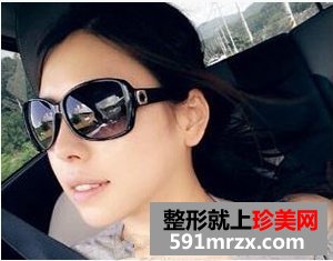 驼峰鼻矫正之后，我感觉生活充满了阳光