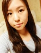 驼峰鼻矫正之后，我感觉生活充满了阳光