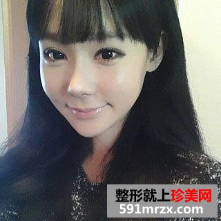 眼袋去除手术之后，“小金鱼”称号不再属于我