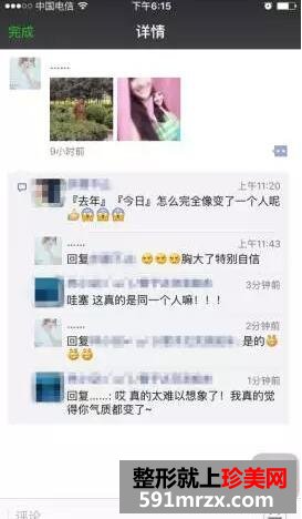 郑州90后瑜伽老师无痕丰胸手术一周后做了什么