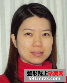 激光洗眉 让我找回那美妙的大学时光