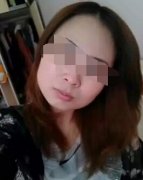 BOTOX瘦脸针过后,脸型得到了很好改善