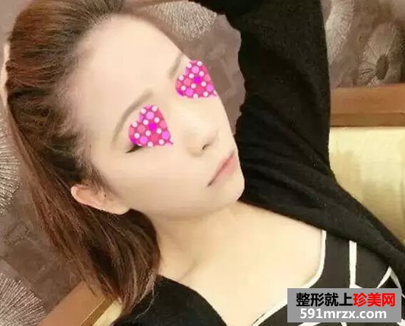 打了瘦脸针 面部精致又有立体感