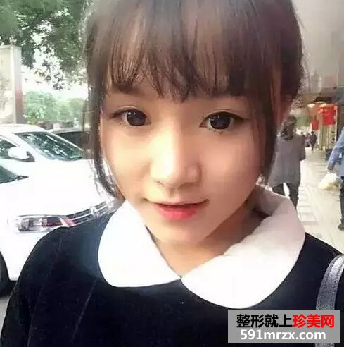 打了botox瘦脸针 我也拥有巴掌脸了