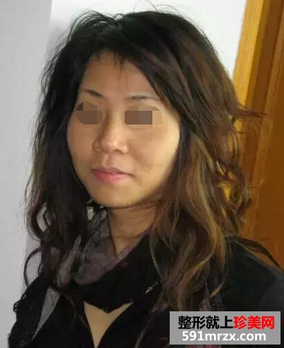做了黑脸娃娃 皮肤真的白了不少