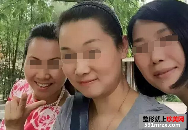 做了黑脸娃娃 皮肤真的白了不少