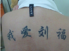 激光洗纹身，不留一点痕迹