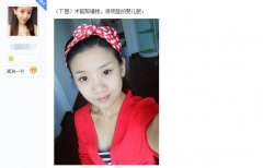 面部吸脂减肥过程，效果不错哦！
