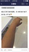 注射美白针五次了，效果越来越明显了