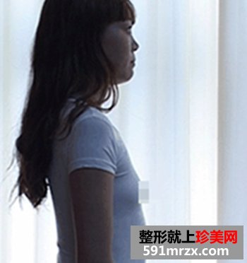 假体隆胸手术 改变了我的人生