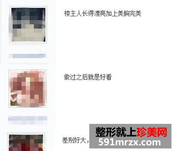 假体隆胸手术 改变了我的人生