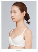 水滴假体隆胸做一个敢于追求幸福的女人！