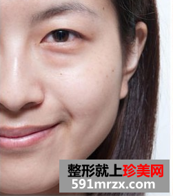 爱贝芙注射美容 让我更加自信美丽
