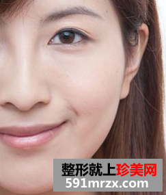 爱贝芙注射美容 让我更加自信美丽