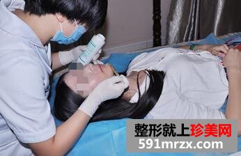 冰点脱唇毛 告别难看的小胡子