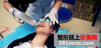 冰点脱唇毛 告别难看的小胡子
