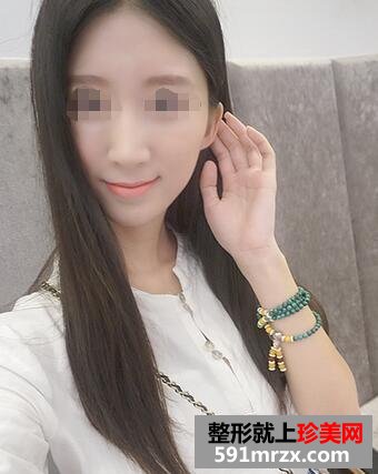 冰点脱唇毛 告别难看的小胡子