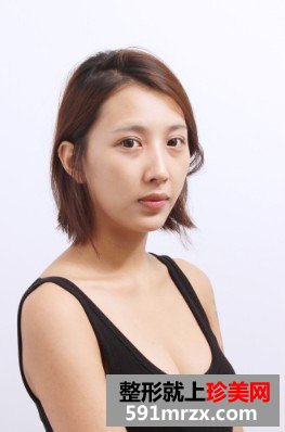 面部自体脂肪移植 我比范冰冰还美