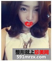 鼻部综合整形+韩式翘睫双眼皮 这下美大发了