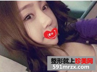 鼻部综合整形+韩式翘睫双眼皮 这下美大发了