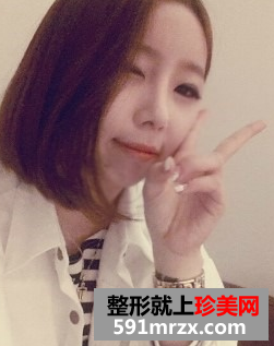 硅胶假体隆鼻+自体脂肪丰额头 驾驭各种发型