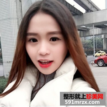 硅胶假体隆鼻好吗 看看我的变化就知道了