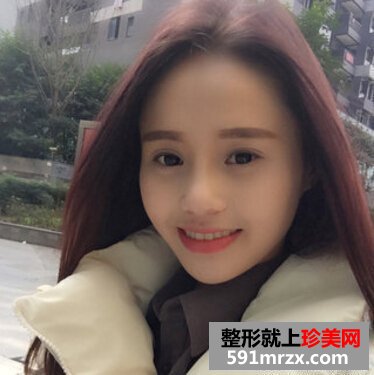硅胶假体隆鼻好吗 看看我的变化就知道了