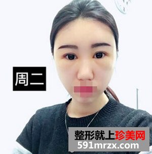 当丑女变成美女 你能体会我是怎样一种心情吗