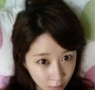 开内眼角手术对比照片眼睛更大了