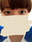 温州加美整形医院做的平行双眼皮假小子到女神的蜕变