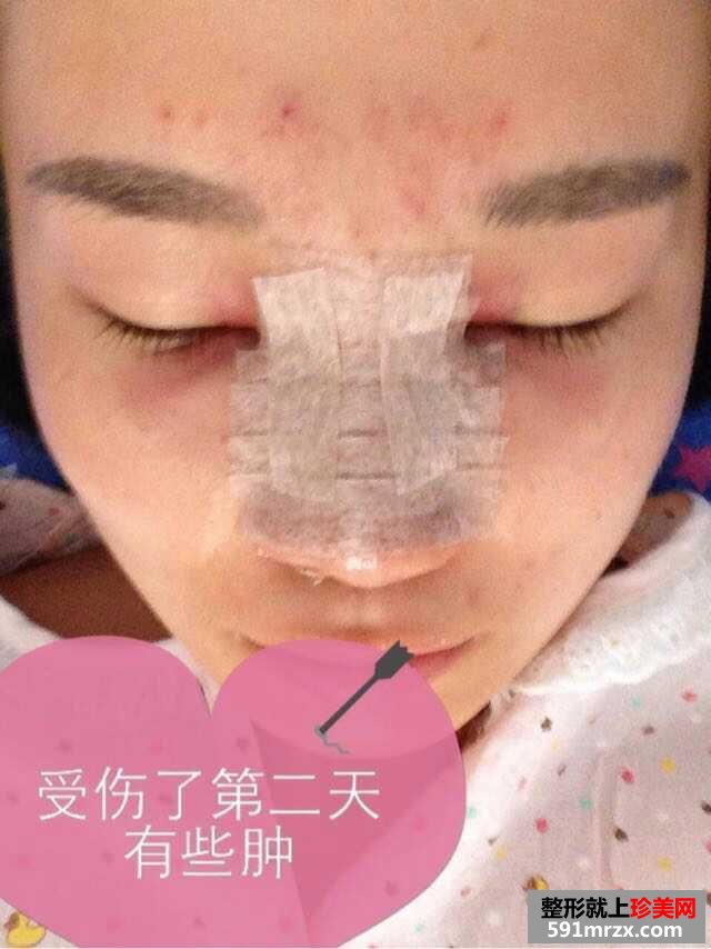 哈尔滨艺星整形医院