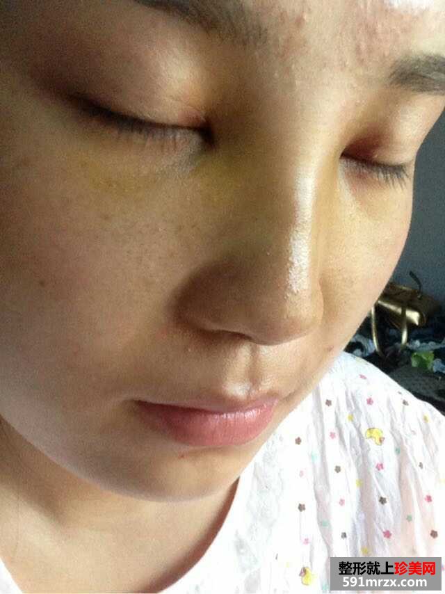哈尔滨艺星整形医院