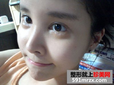北京八大处整容医院,自体脂肪填充多少钱