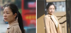 注射式隆鼻+自体脂肪丰苹果肌自卑剩女变快乐“百灵鸟”