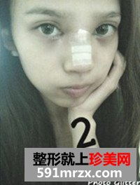 温州,加美,整形,美容,医院,双眼皮,隆胸,隆鼻