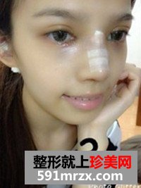 温州,加美,整形,美容,医院,双眼皮,隆胸,隆鼻
