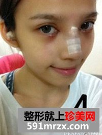 温州,加美,整形,美容,医院,双眼皮,隆胸,隆鼻