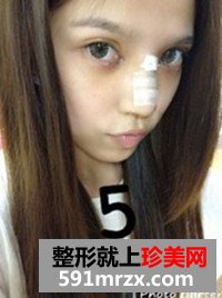 温州,加美,整形,美容,医院,双眼皮,隆胸,隆鼻