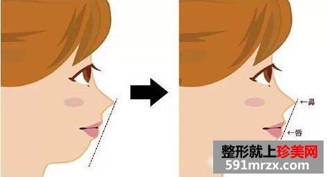 服装,设计师,隆下巴,淘女郎