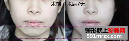 服装,设计师,隆下巴,淘女郎